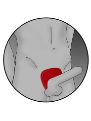 Electrastim - Scudo Per Pene Viper Fusion In Silicone - ELECTRASTIM - Anelli Fallici | erosidea.com