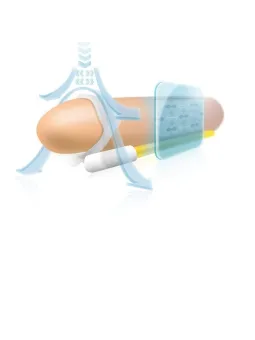 erosidea.com - ANDRO MEDICAL