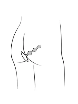 erosidea.com - Plug e Catene Anali